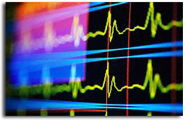 frequences.jpg (25440 octets)